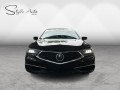 2018 Acura TLX - Thumbnail 2